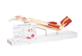 Braço com Ossos /Músculos /Ligamentos e Nervos