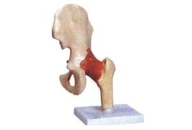 Articulação do Quadril