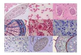 Lâmina Histologia - 80 peças/caixa